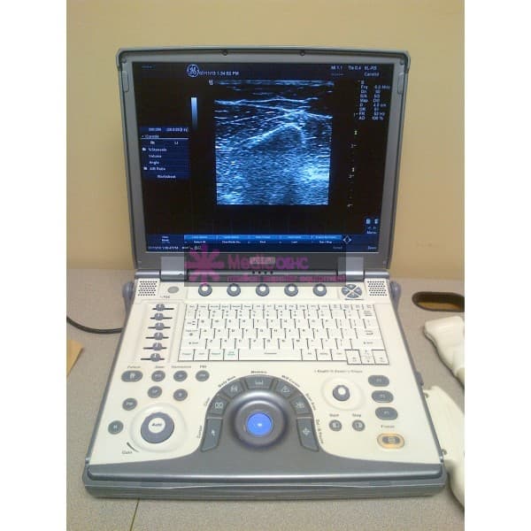 GE Logiq E Portable Ultrasound Machine w DICOM_ 4C and 8L pr